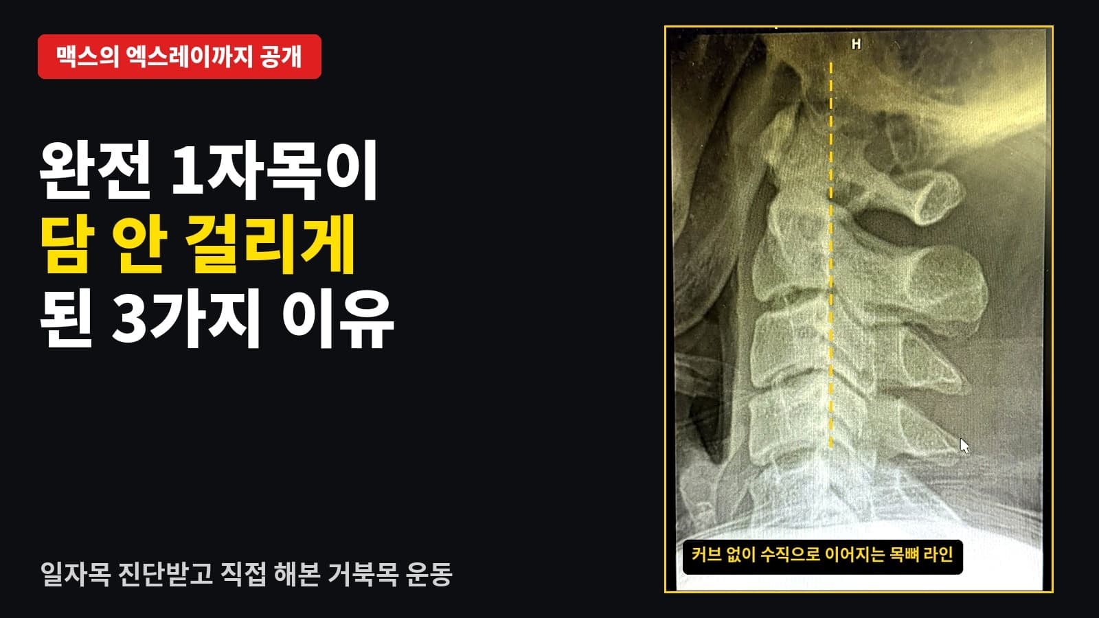 거북목 운동 3가지
